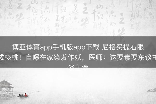 博亚体育app手机版app下载 尼格买提右眼肿成核桃！自曝在家染发作妖，医师：这要素要东谈主命